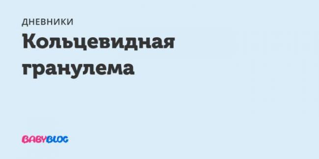 Симптомы и лечение кольцевидной гранулёмы