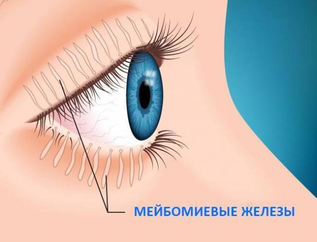 Что такое мейбомит глаза: причины и лечение