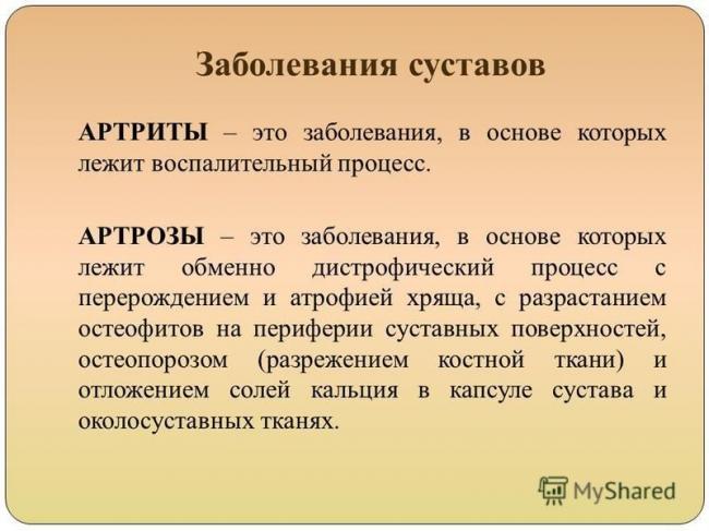 Остеоартрит: симптомы, лечение, причины, диагностика