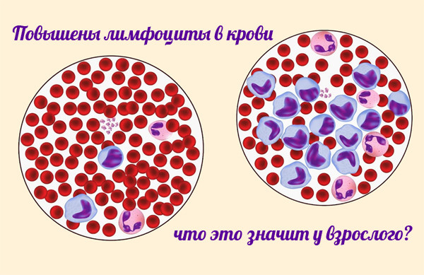 Что такое лейкоцитарная формула и как проводится ее расшифровка