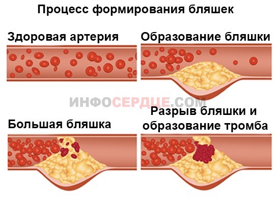 4 эффективных рецепта для чистки сосудов с помощью клюквы, чеснока и меда