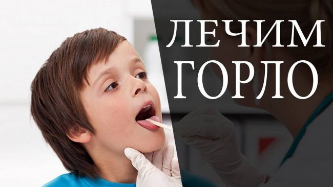 Раствор для полоскания горла: оки, фурацилина, сода, соль, йод, хлорофиллипт, спиртовой, мирамистин, йодинол