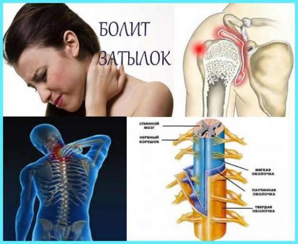 Причины пульсирующей боли в пояснице