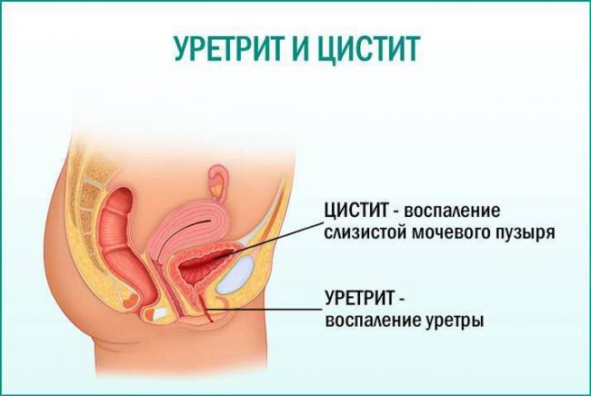 Амоклав - 1000, таблетки