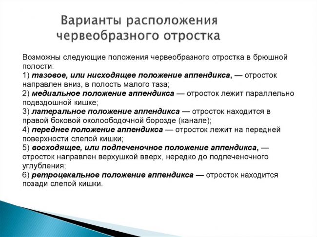 Признаки аппендицита