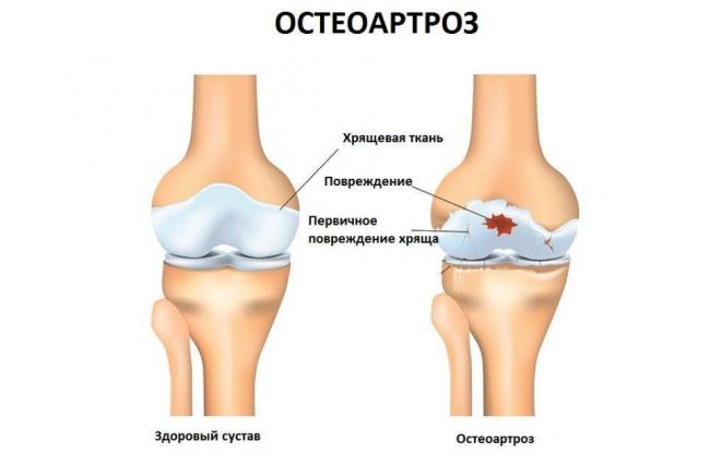 Уколы Драстоп: инструкция по применению, цена, отзывы