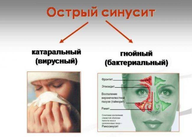 Геломиртол: инструкция по применению, отзывы, цена капсул