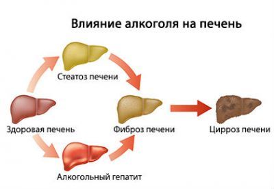 Чем отличается фиброз от цирроза печени?