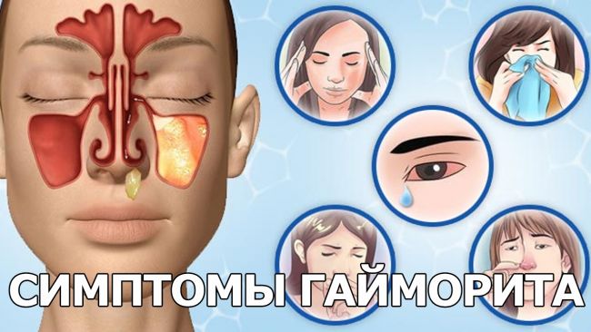 Как очистить лобные пазухи от гноя