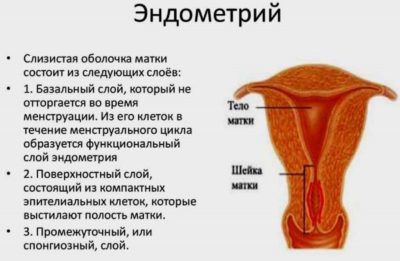 Рак эндометрия