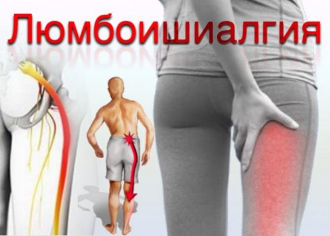 Лечение цервикокраниалгии на фоне шейного остеохондроза