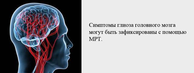 Глиозные изменения головного мозга