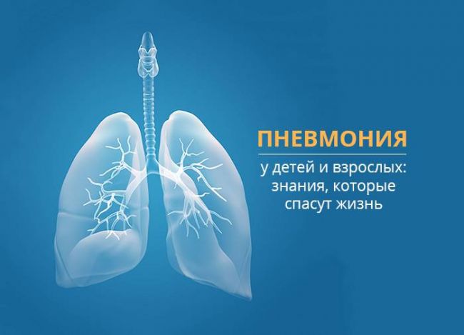 Описание рентгенологических признаков воспаления легких
