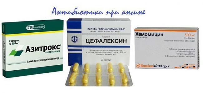 Лучшие антибиотики при отите у взрослого, ребенка. таблетки, уколы, капли