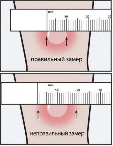 Крым астматикам, куда? - запись пользователя евгения (keeso) в сообществе активный отдых в категории курорты россии и украины - babyblog.ru