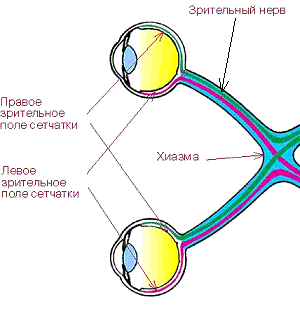 Лечение гемианопсии после инсульта