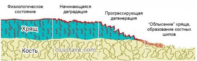 Сустанорм крем бальзам инструкция по применению