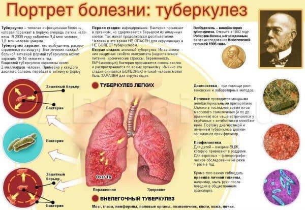 Контакт с туберкулезом