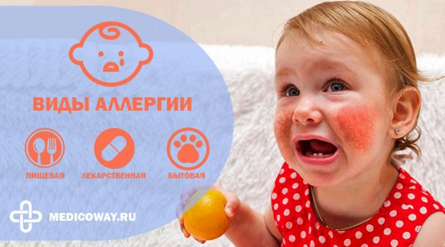 Причины и лечение диатеза у грудничков, профилактика и прогноз для ребенка