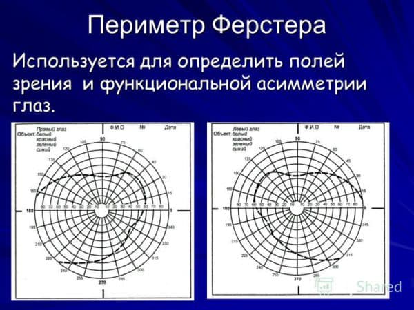 Периметрия: как делается, расшифровка, нормальные показатели