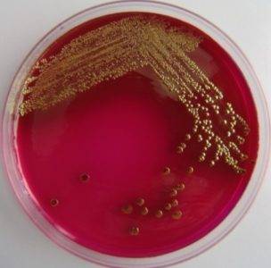 Escherichia coli 10/6 в моче