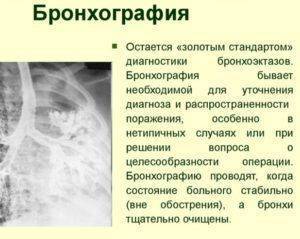 Бронхи - симптомы заболеваний, лечение болезней дыхательных путей
