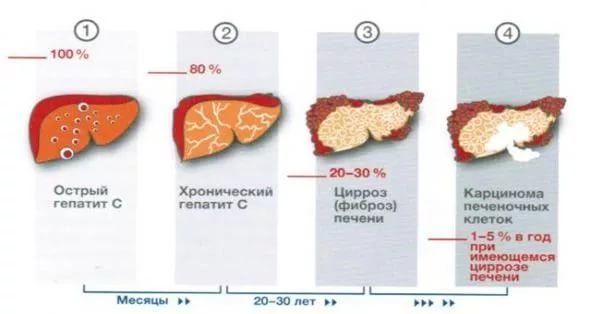 Препараты нового поколения в терапии гепатита с