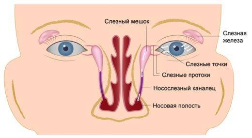 Как мы вылечили непроходимость слезного канала (дакриоцистит) без зондирования