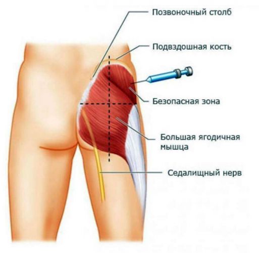 Средства, стимулирующие регенерацию Nycomed Takeda АКТОВЕГИН, раствор для инъекций - отзыв