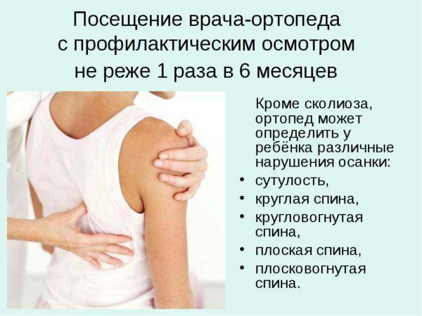 Какой врач лечит сколиоз (искривление позвоночника)