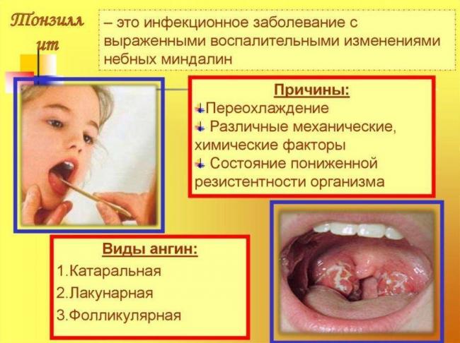 Противовирусные препараты при ангине для детей комаровский