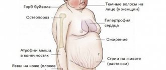 Сонная болезнь - симптомы, возбудитель, профилактика и лечение