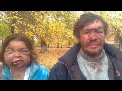 Цвет глаз определяет риск алкоголизма