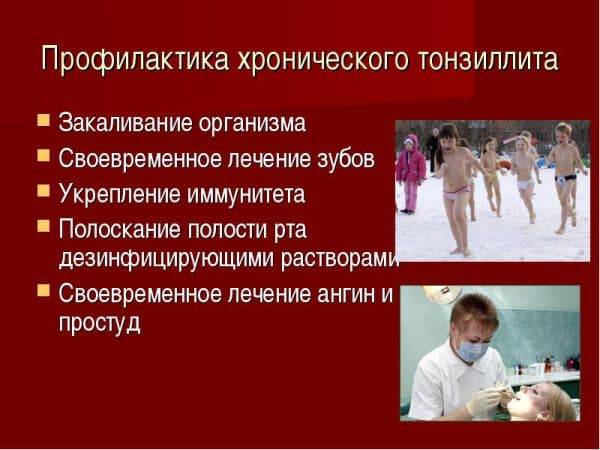 Мкб 10 гипертрофия миндалин с гипертрофией аденоидов