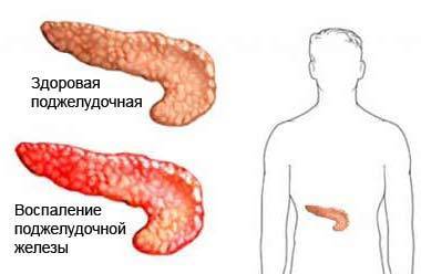 Причины пульсирующей боли в пояснице