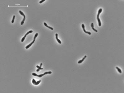Bifidobacterium longum (бифидобактерии лонгум)