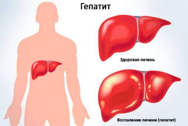 При вздохе болит правый бок под ребрами