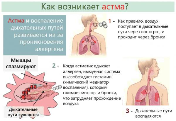 Бронхиальная астма. симптомы и лечение у взрослых. признаки, классификация, осложнения, обострение, причины