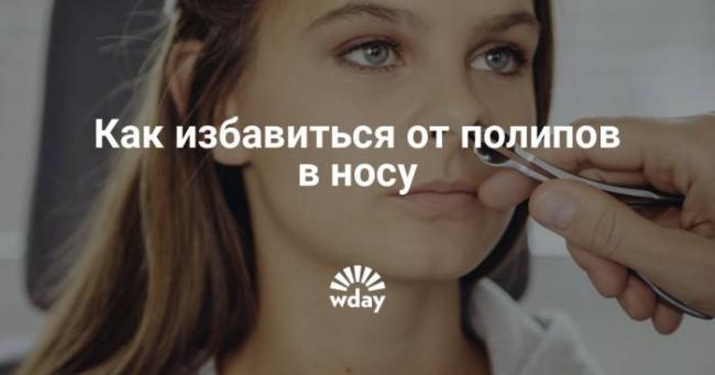 Лечение полипов в носу чистотелом: рецепты народной медицины - onwomen.ru