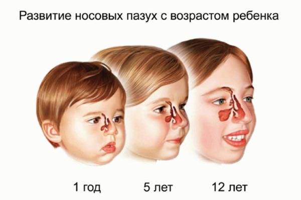 Как убрать и вылечить заложенность носа у ребенка?