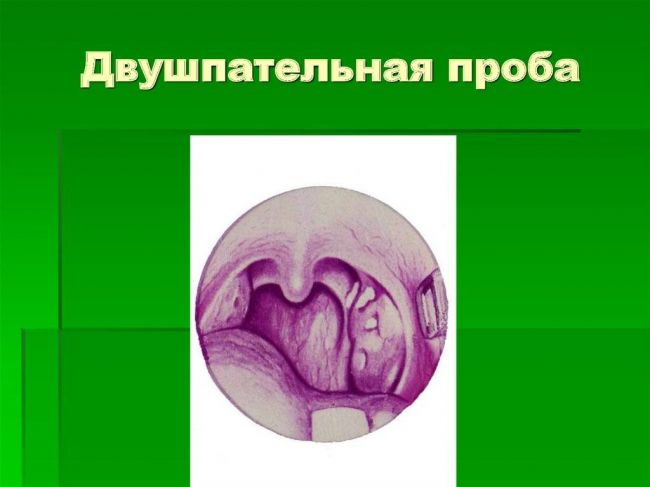 Хронический тонзиллит компенсированная форма