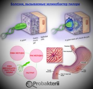 Бактериальные аллергены