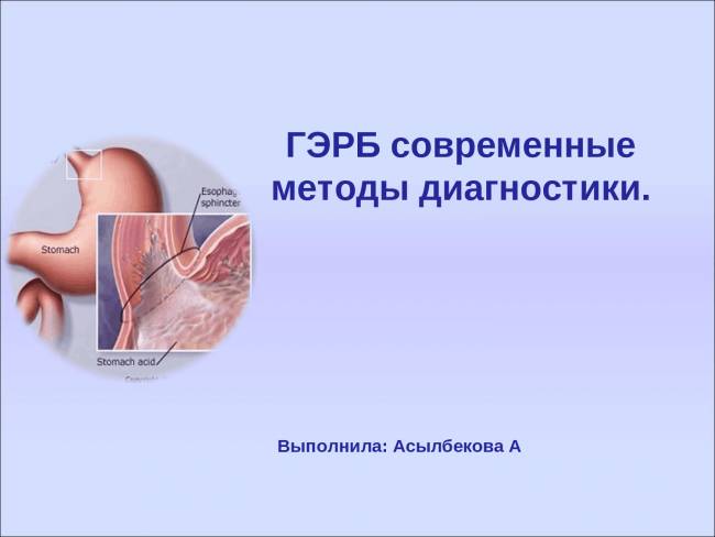 Что такое гастроэзофагеальный рефлюкс с эзофагитом, гэрб — описание, симптомы и лечение