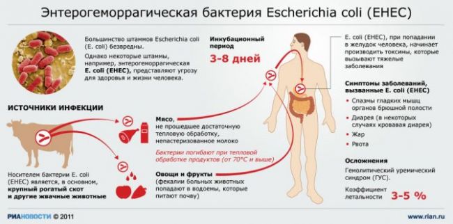 Escherichia coli в моче — диагностика, причины появления