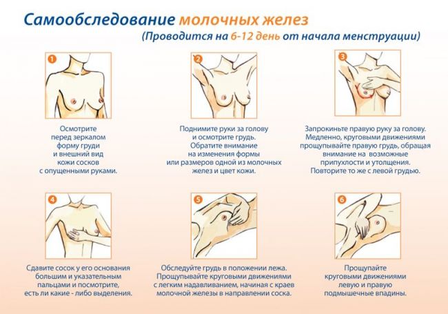 Фиброаденома - стоит ли волноваться?