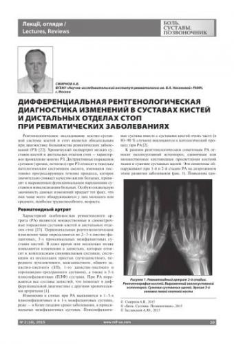 Что такое остеоартроз, его симптомы и лечение