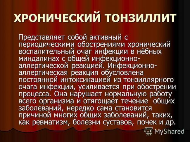 Что такое хронический субкомпенсированный тонзиллит?