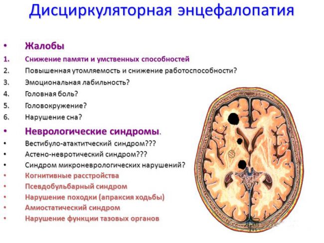Энцефалопатия головного мозга: виды, признаки и проявления, лечение