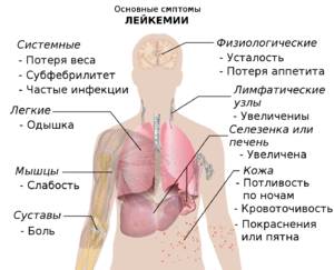 Как распознать лейкемию по анализу крови