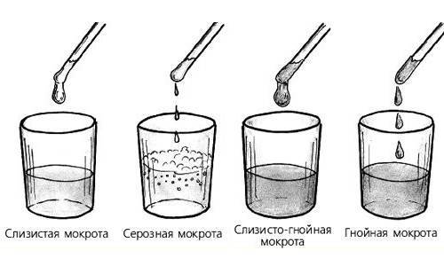 Желтая мокрота при кашле: причины появления. способы лечения